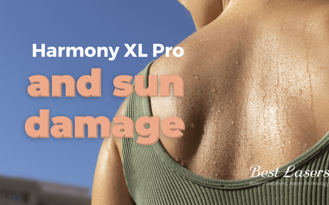 Sun damaged skin?