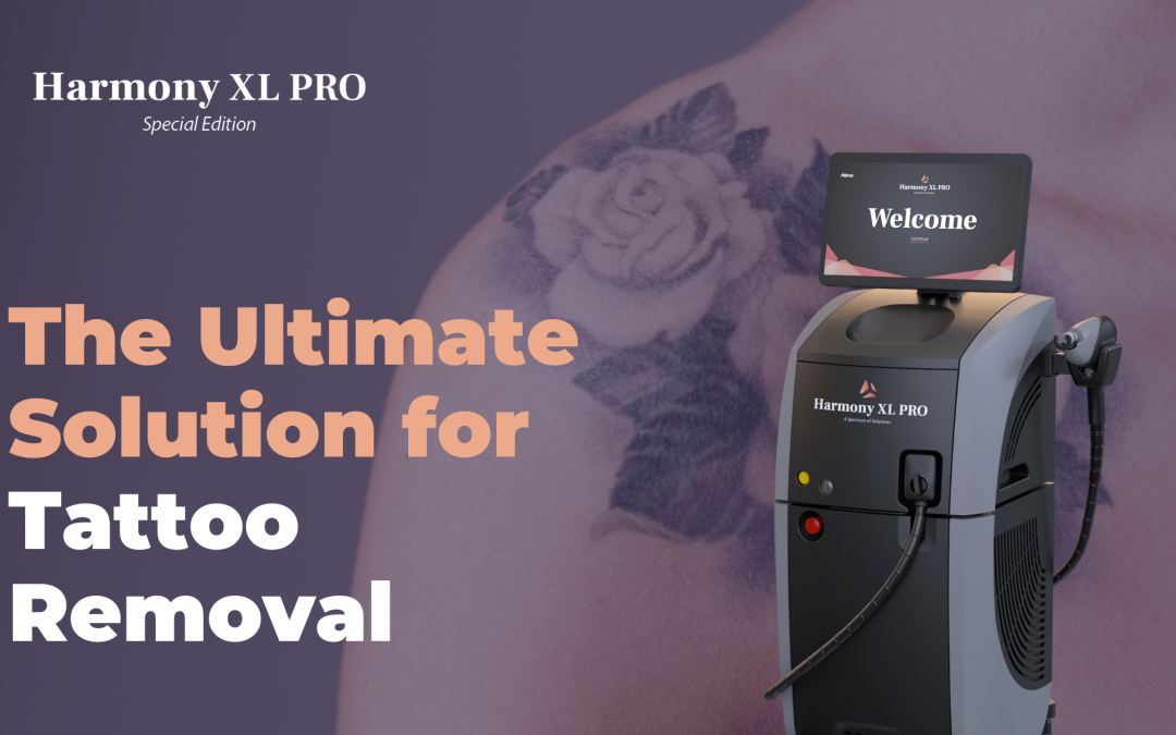 Harmony XL Pro: The Ultimate Solution for Tattoo Removal